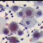 Κυτταρα ενδοτραχήλου 